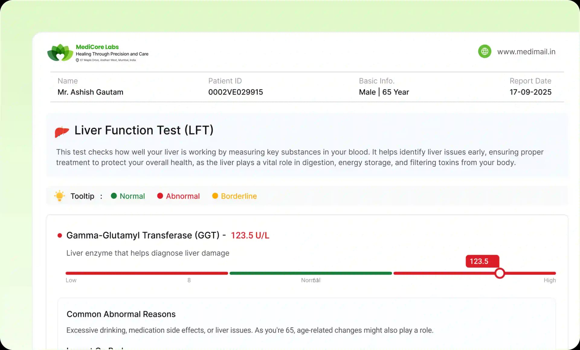 AI Smart Reports