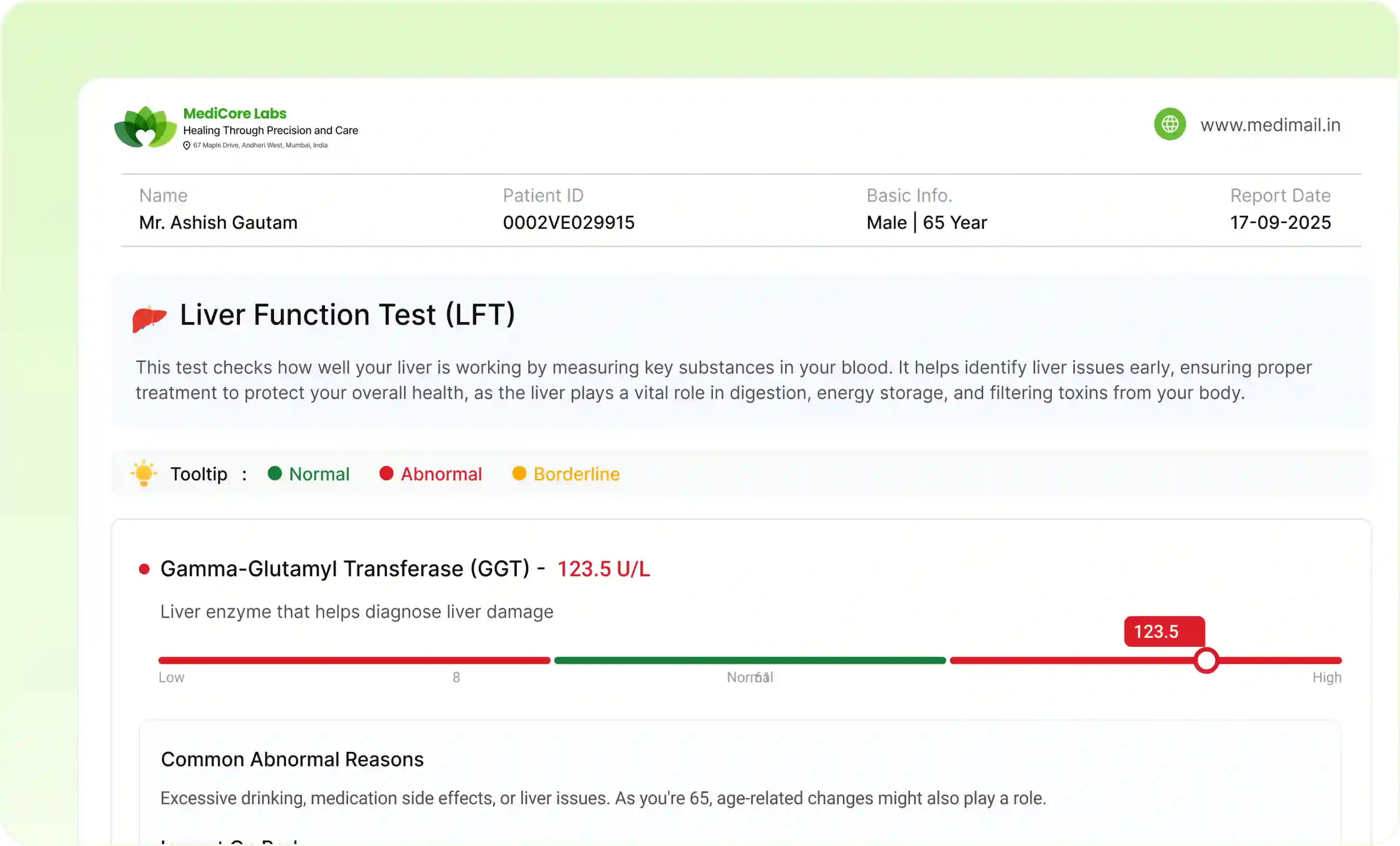 AI Smart Reports