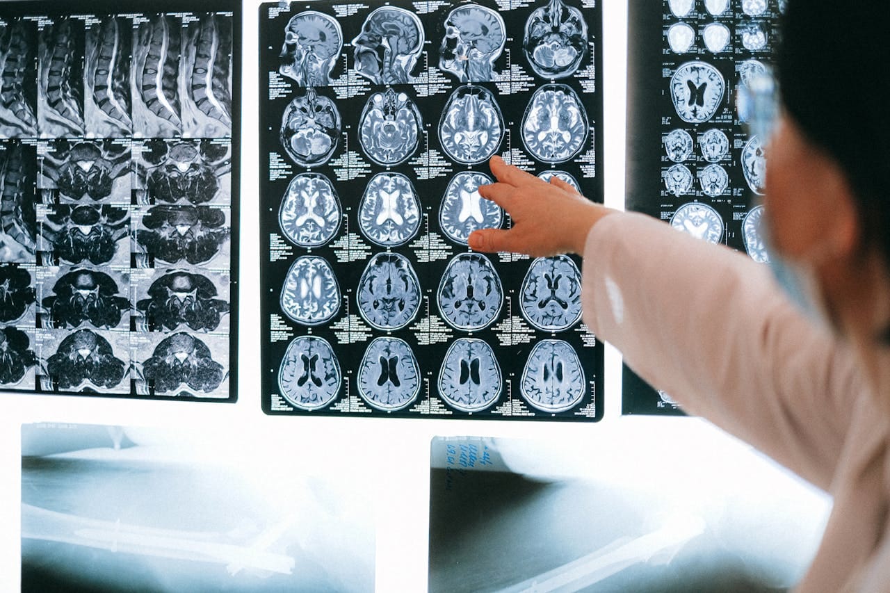 Top 10 Radiology Software for Enhanced Diagnostic Imaging