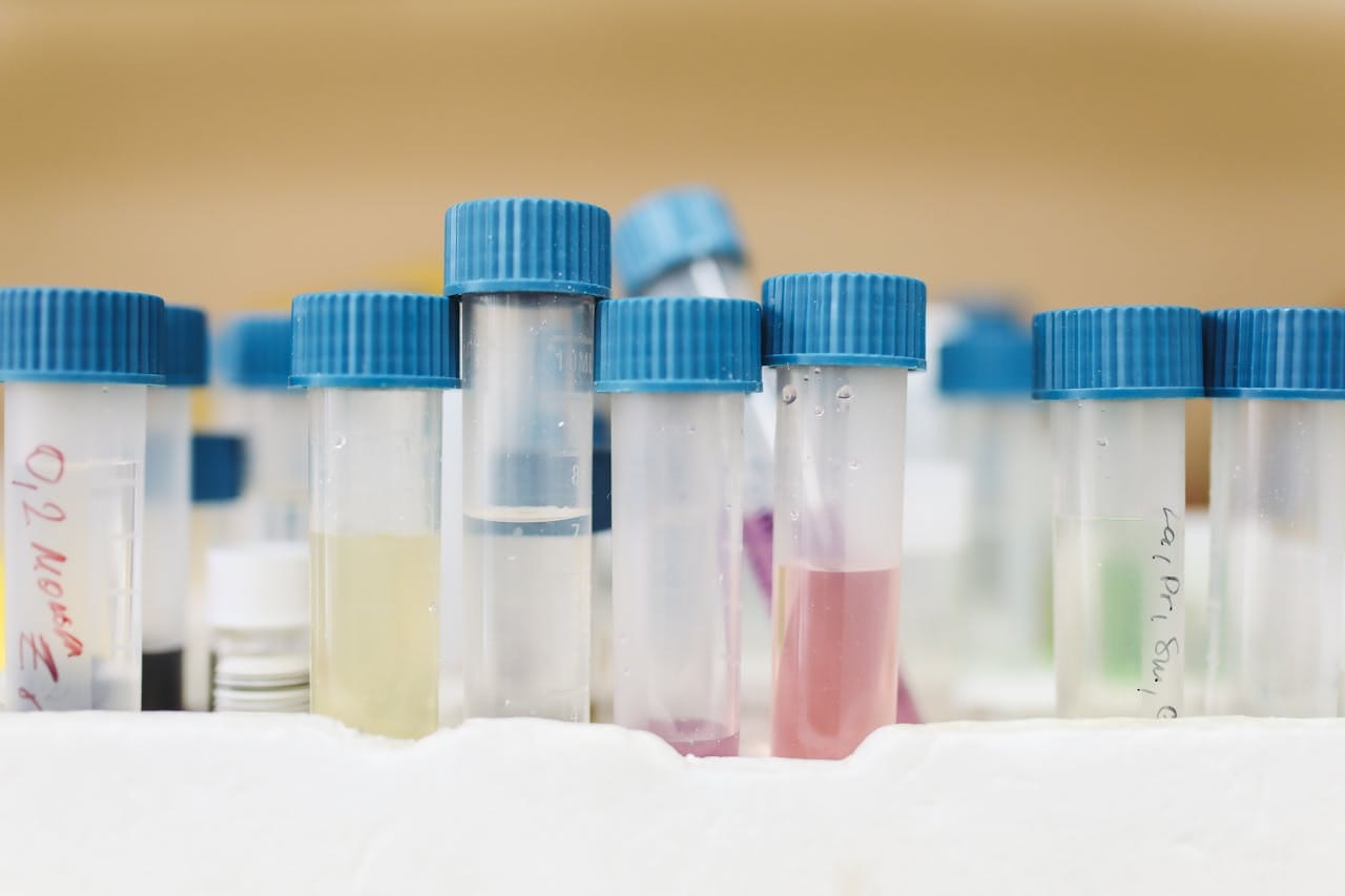 Exploring the Difference Between Urine Routine and Urine Culture