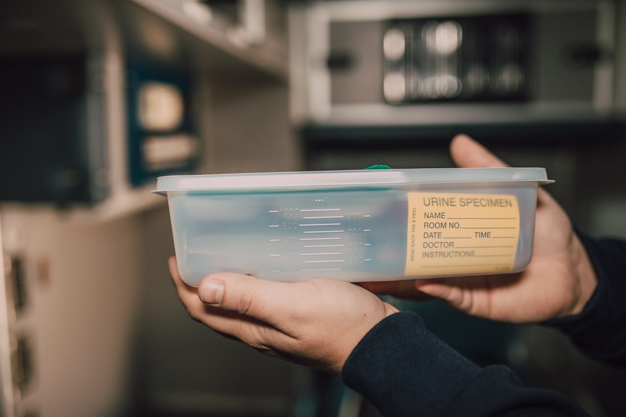 Urine Culture Report: Key Results Explained