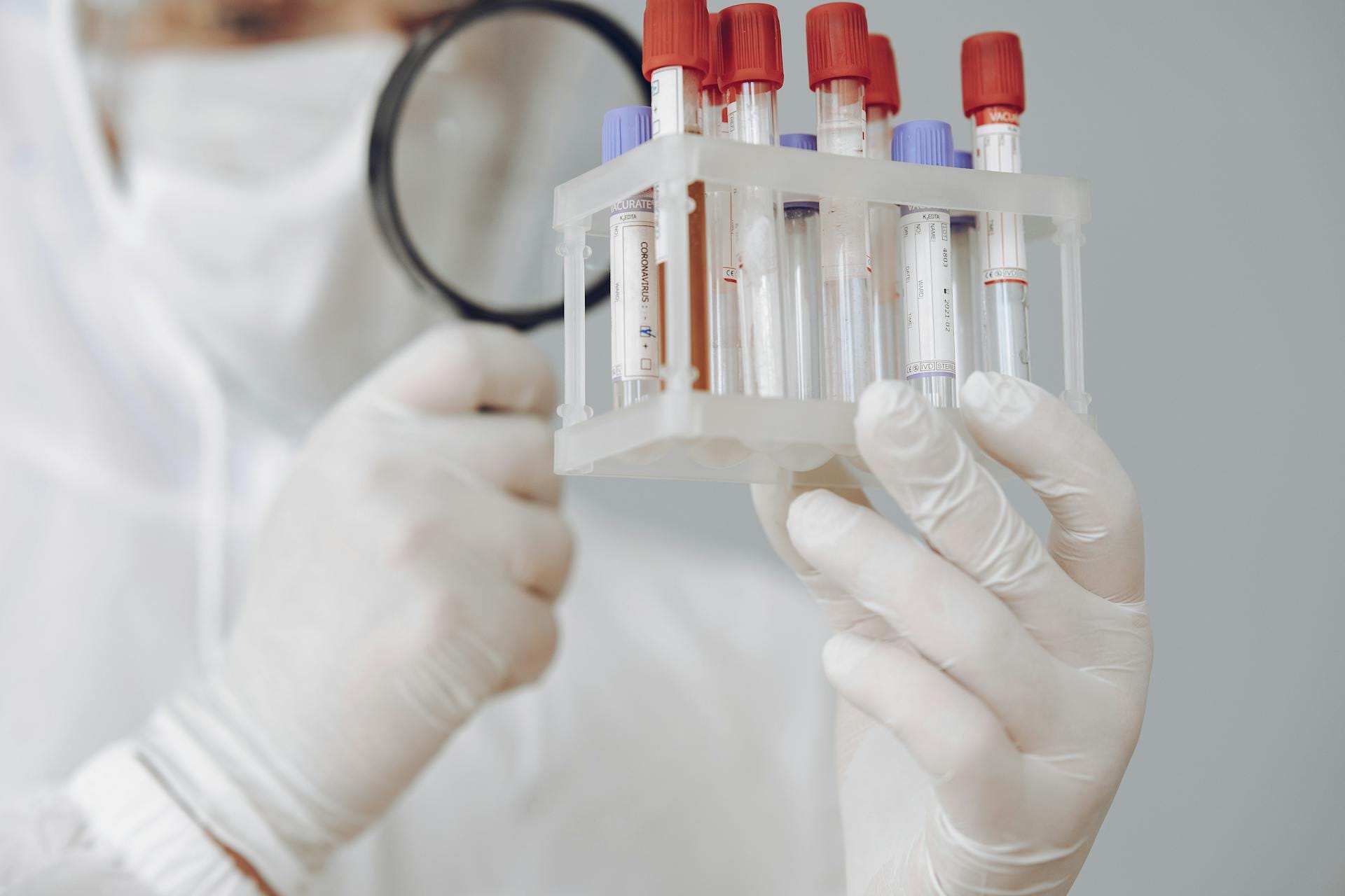 CBC with ESR Test Guide – Meaning, Use & Results