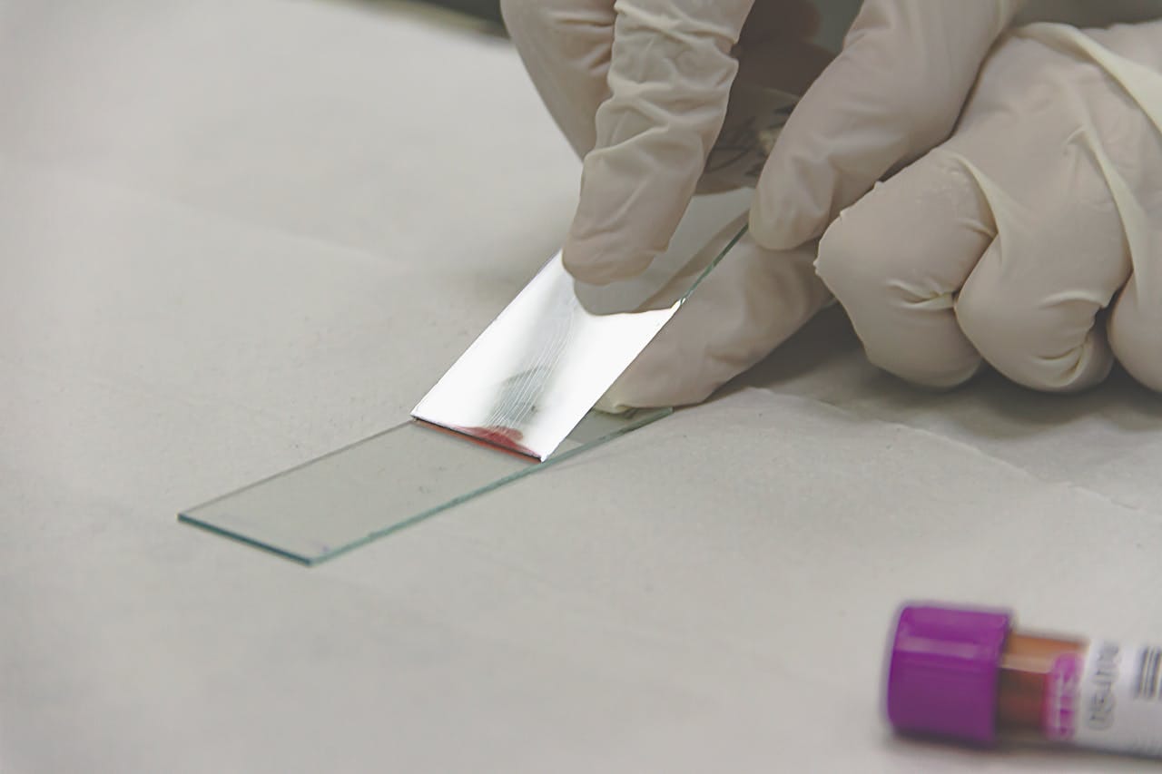 Comprehensive Guide to Hematology Tests: List, Price and Procedure