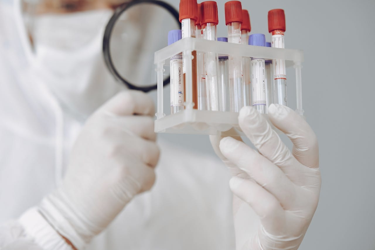 Vacutainer Colour Coding Guide: Tube Colours, Additives & Test Uses