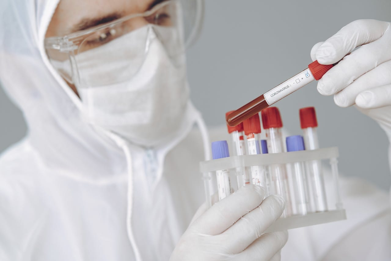 Importance of Blood Group Test : Why Knowing Your Blood Type Matters