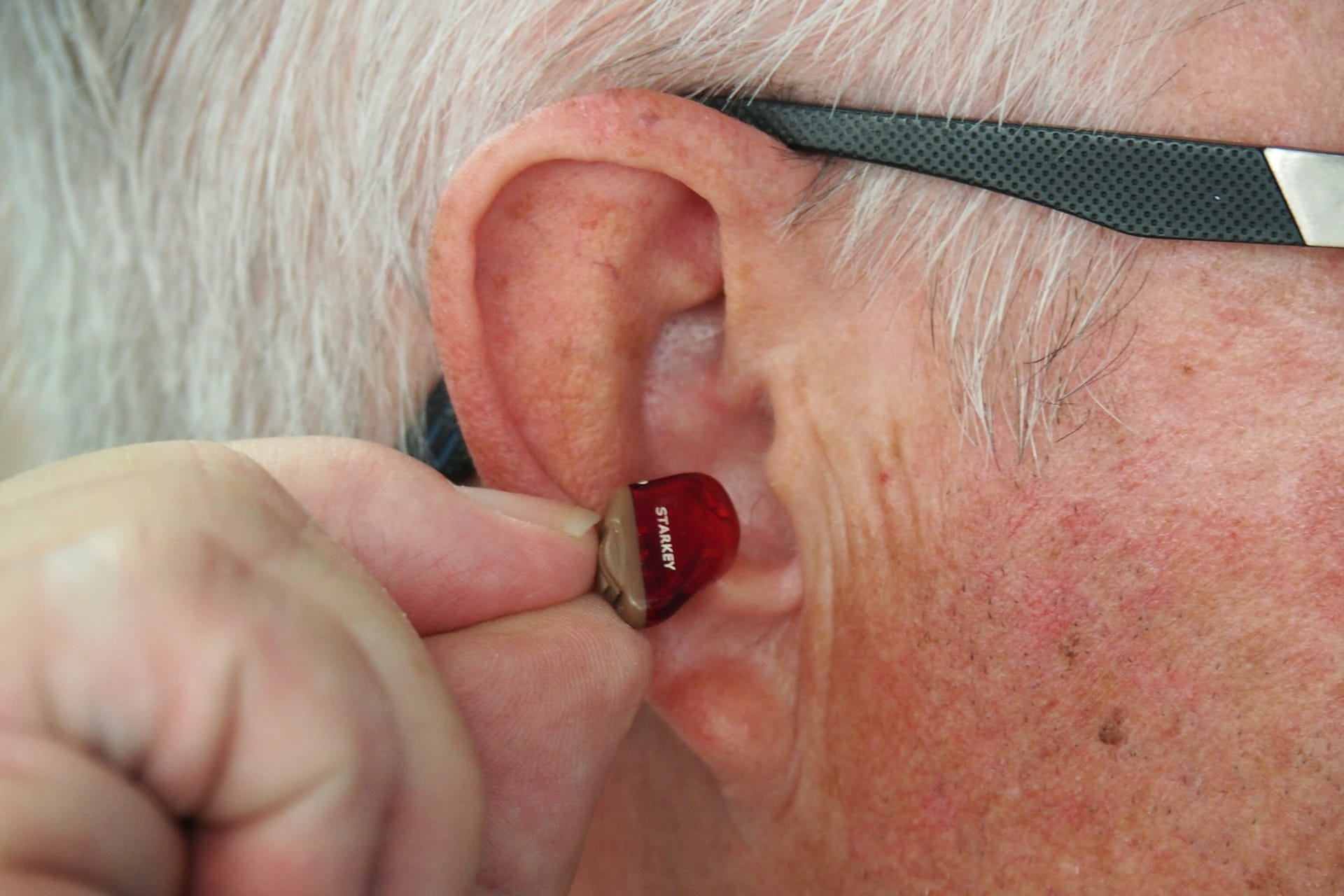 BERA Test Interpretation: A Guide to Hearing Assessment Results