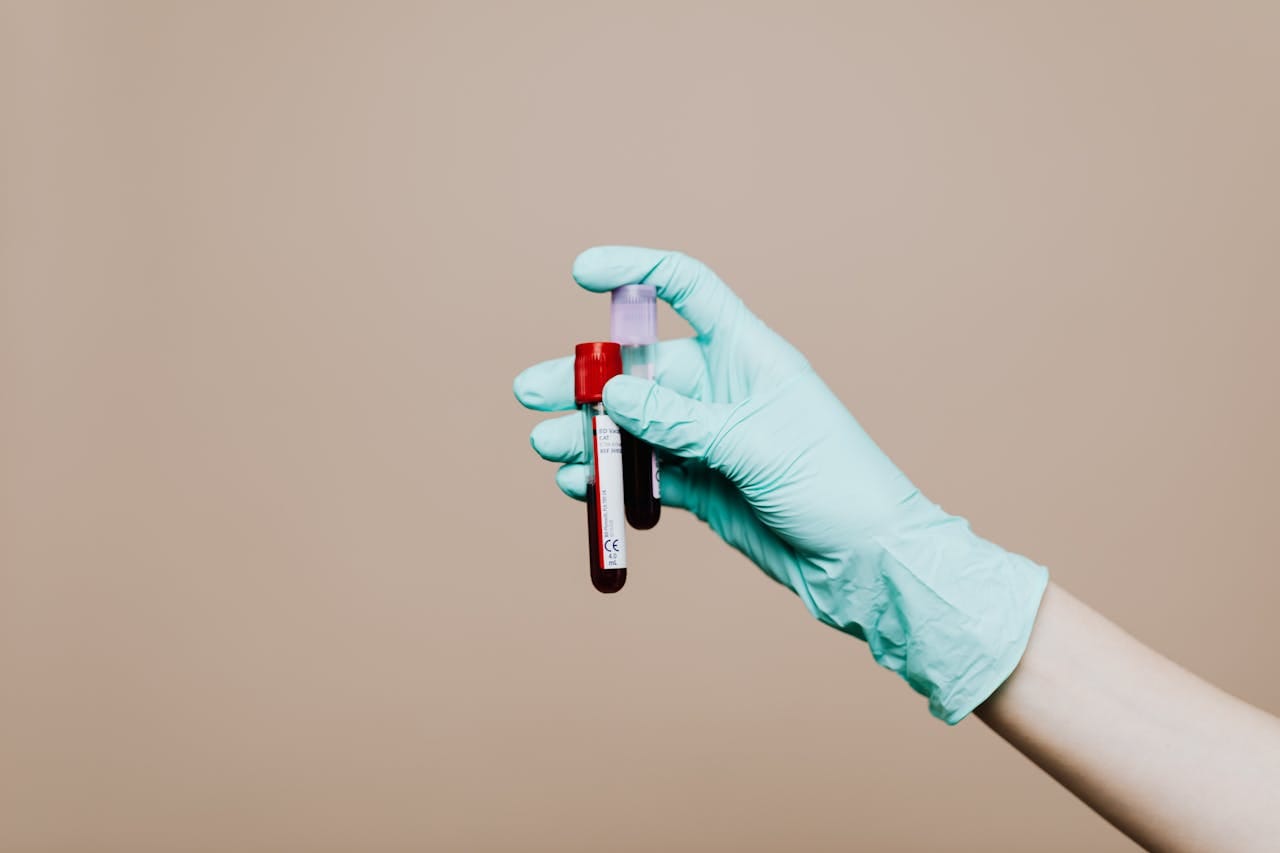 Interpreting Your Blood Culture Report: What to Expect