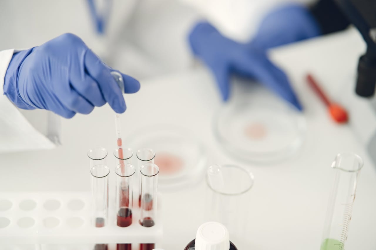 Hemochromatosis Genetic Test: Purpose, Process & Results