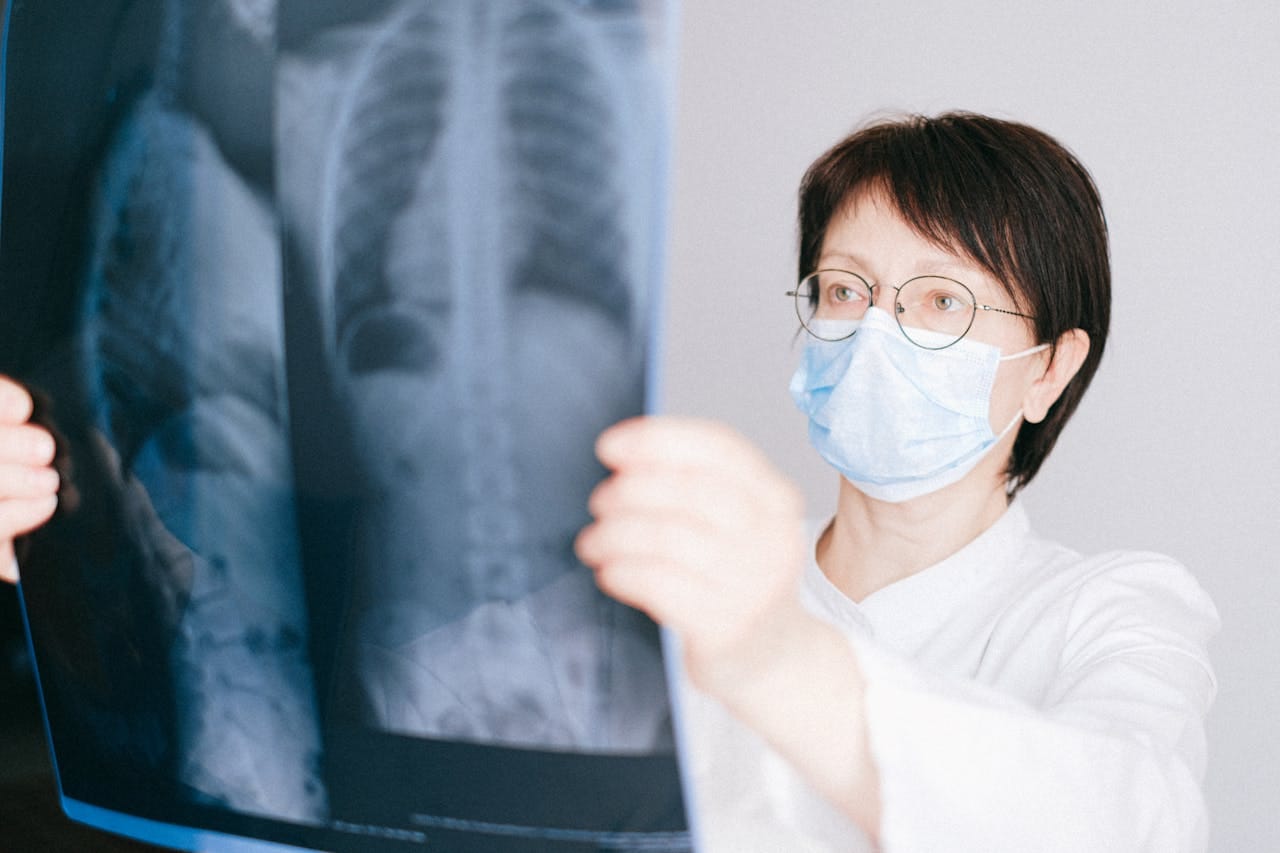 Understanding the Anatomy of a Normal Chest X-Ray