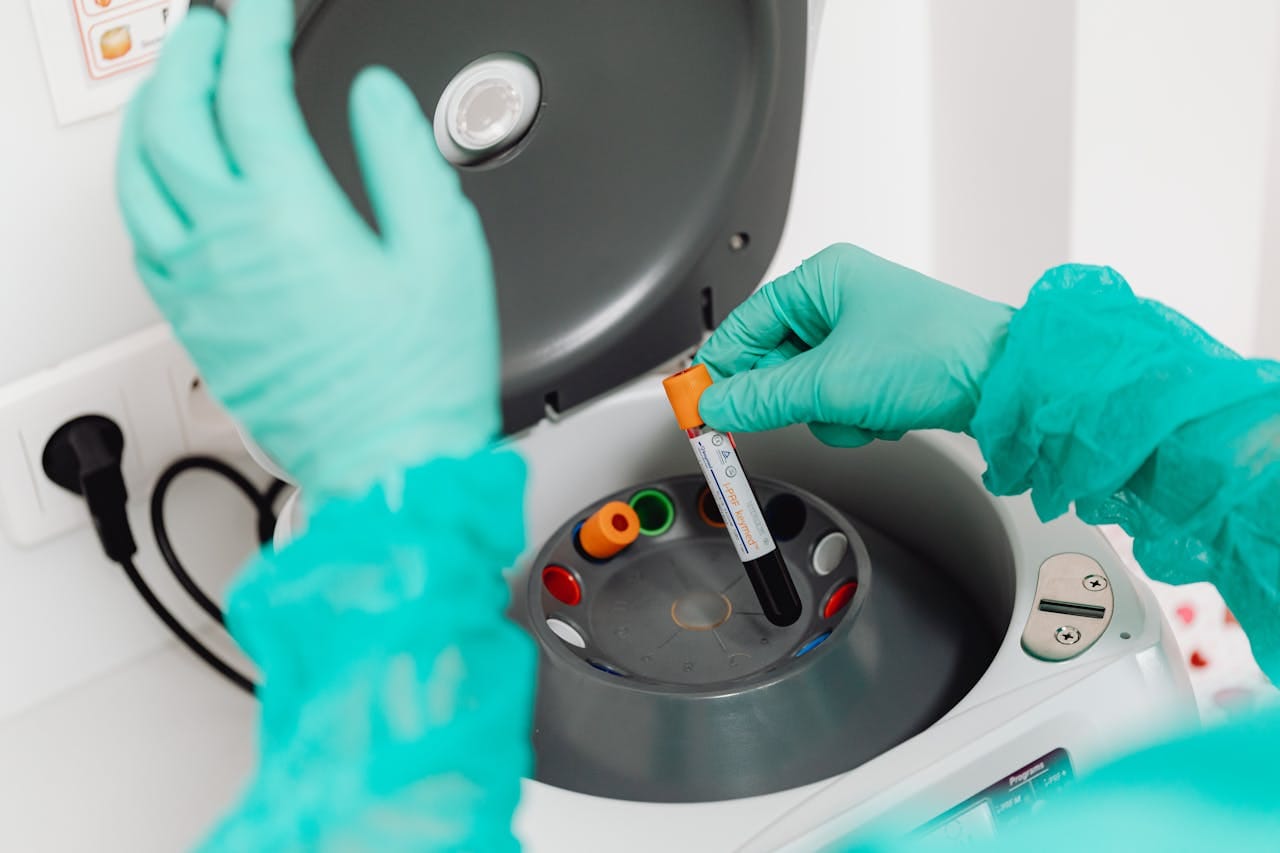 Essential Serology Tests for Accurate Diagnosis