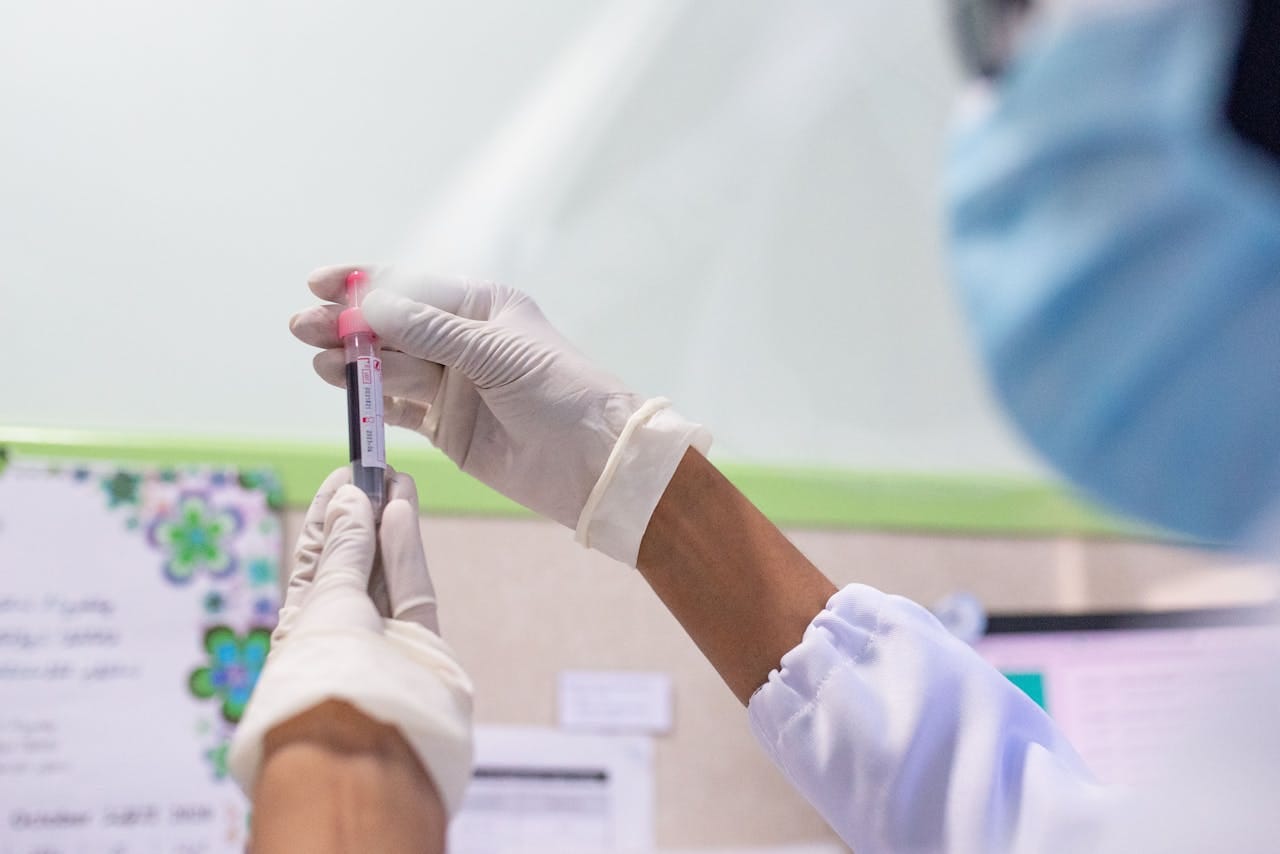 Anti-TPO Antibody Test: Why It’s Done and What It Means