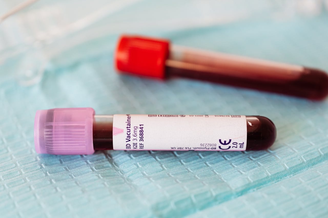 Blood Group Test Procedure & Importance Explained