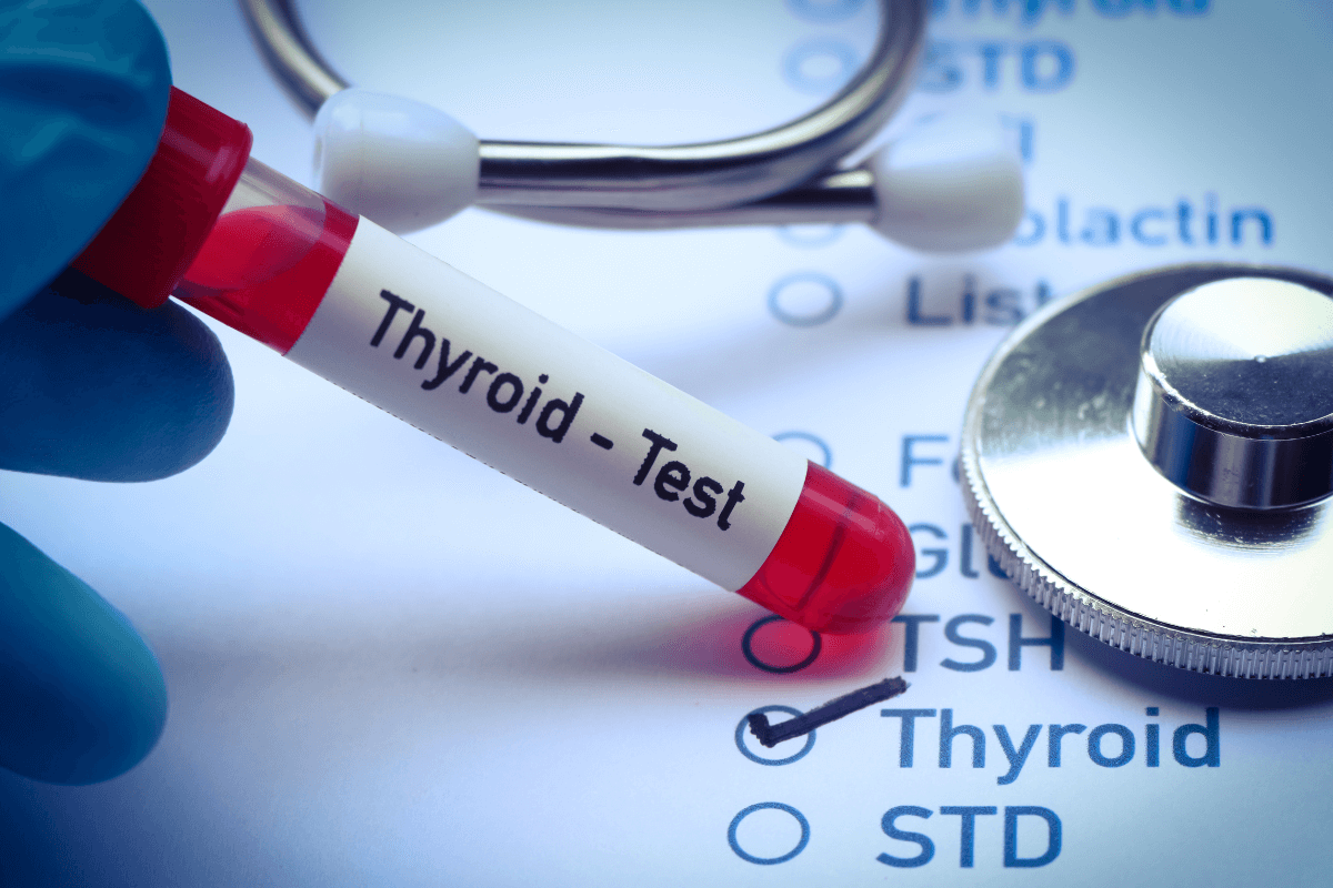 Thyroid Test Report Format: Download Sample & Free PDF