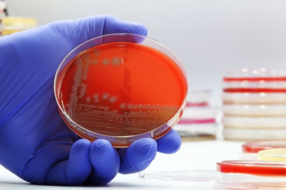 Difference Between Meningitis and Encephalitis Explained