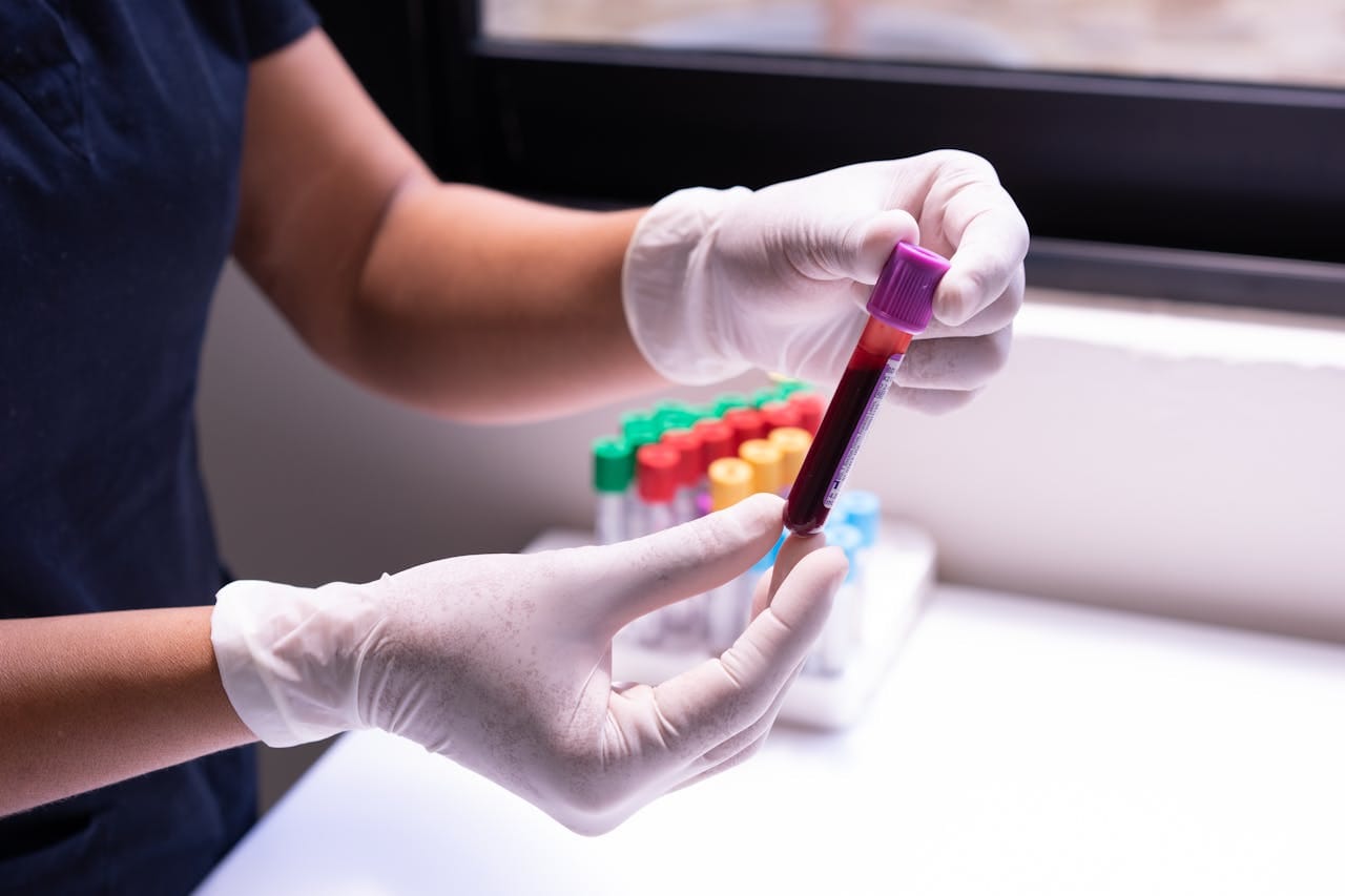 Different Vacutainer Types and Their Uses Explained