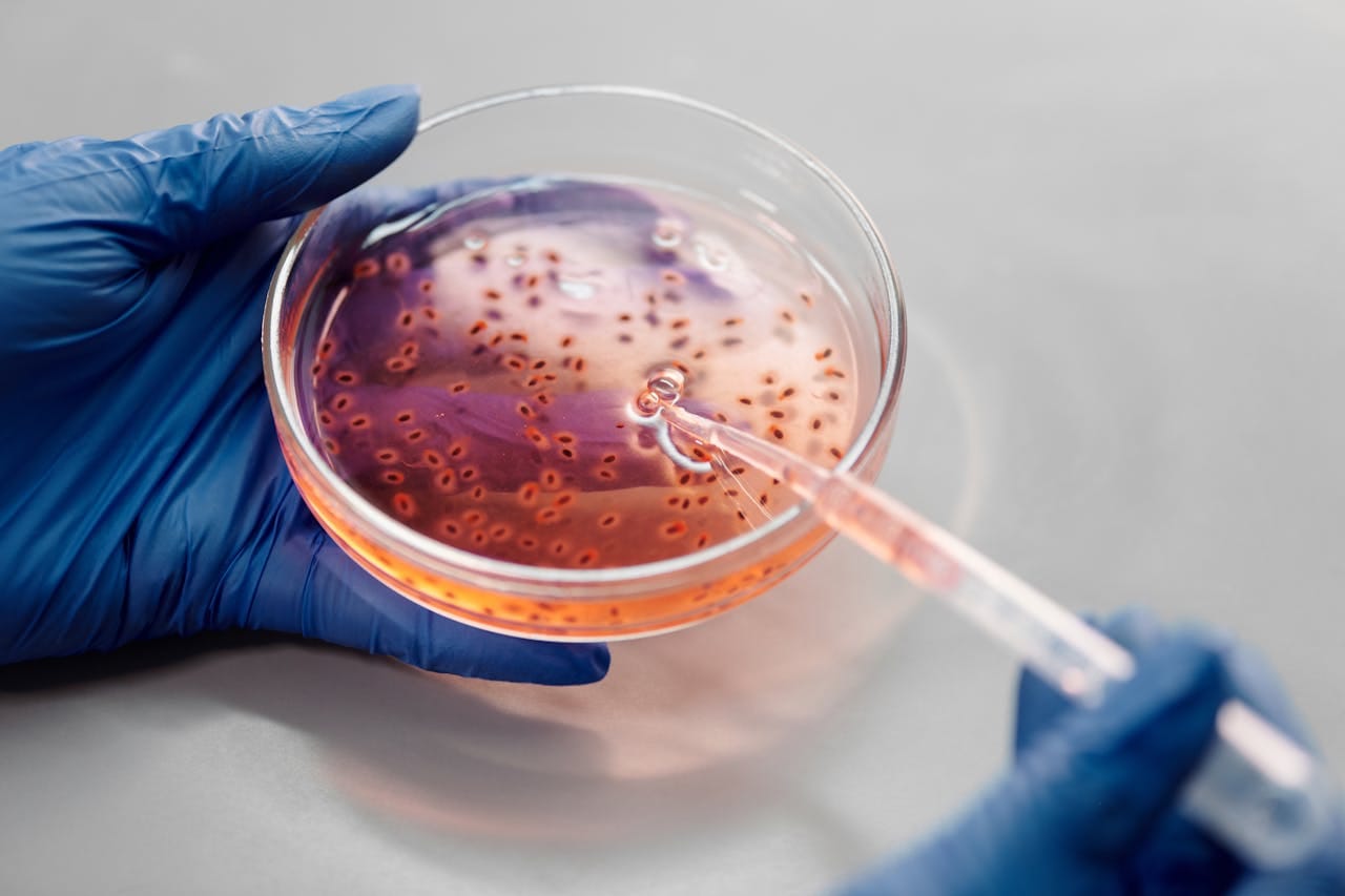 Difference Between Staphylococcus and Streptococcus Explained