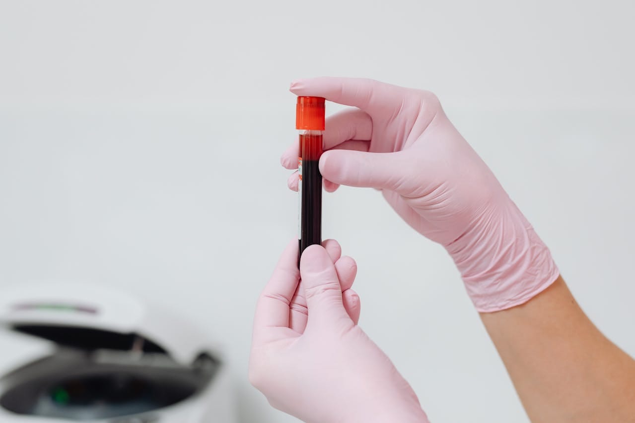 Mastering the Blood Collection Procedure: Best Practices and Guidelines