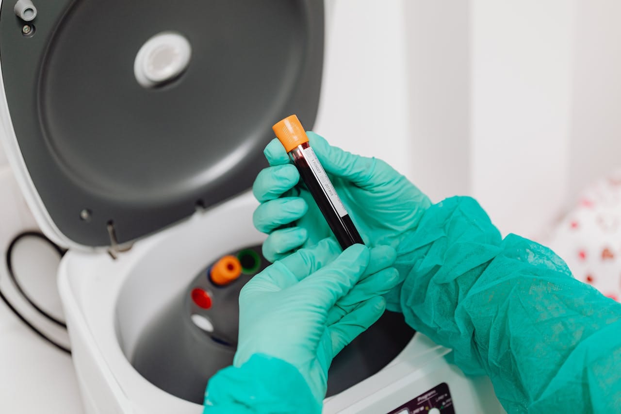 EDTA Blood Test: Key Uses in Hematology