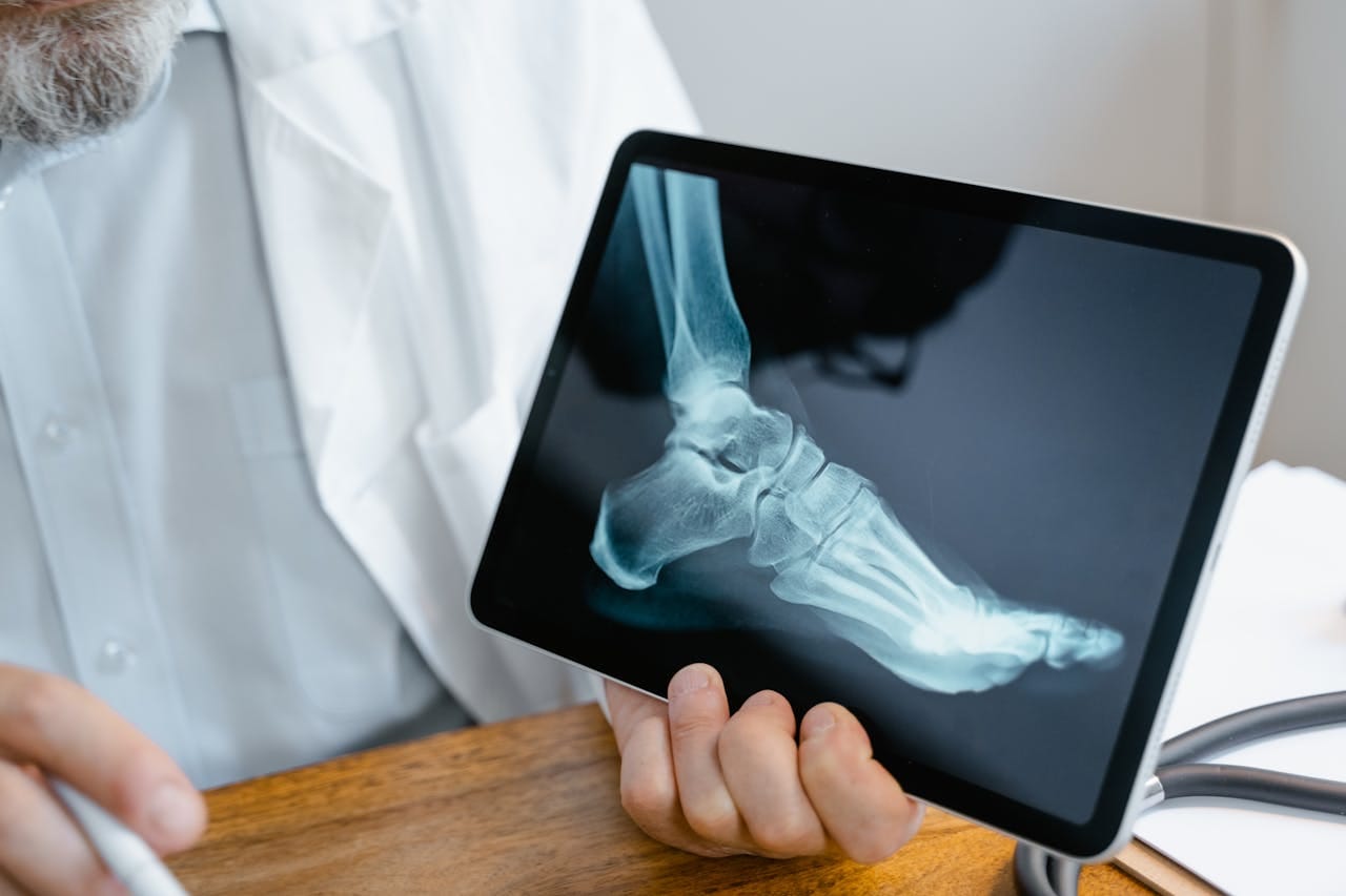 X-Ray Foot AP LAT: Views, Procedure, Uses & Results