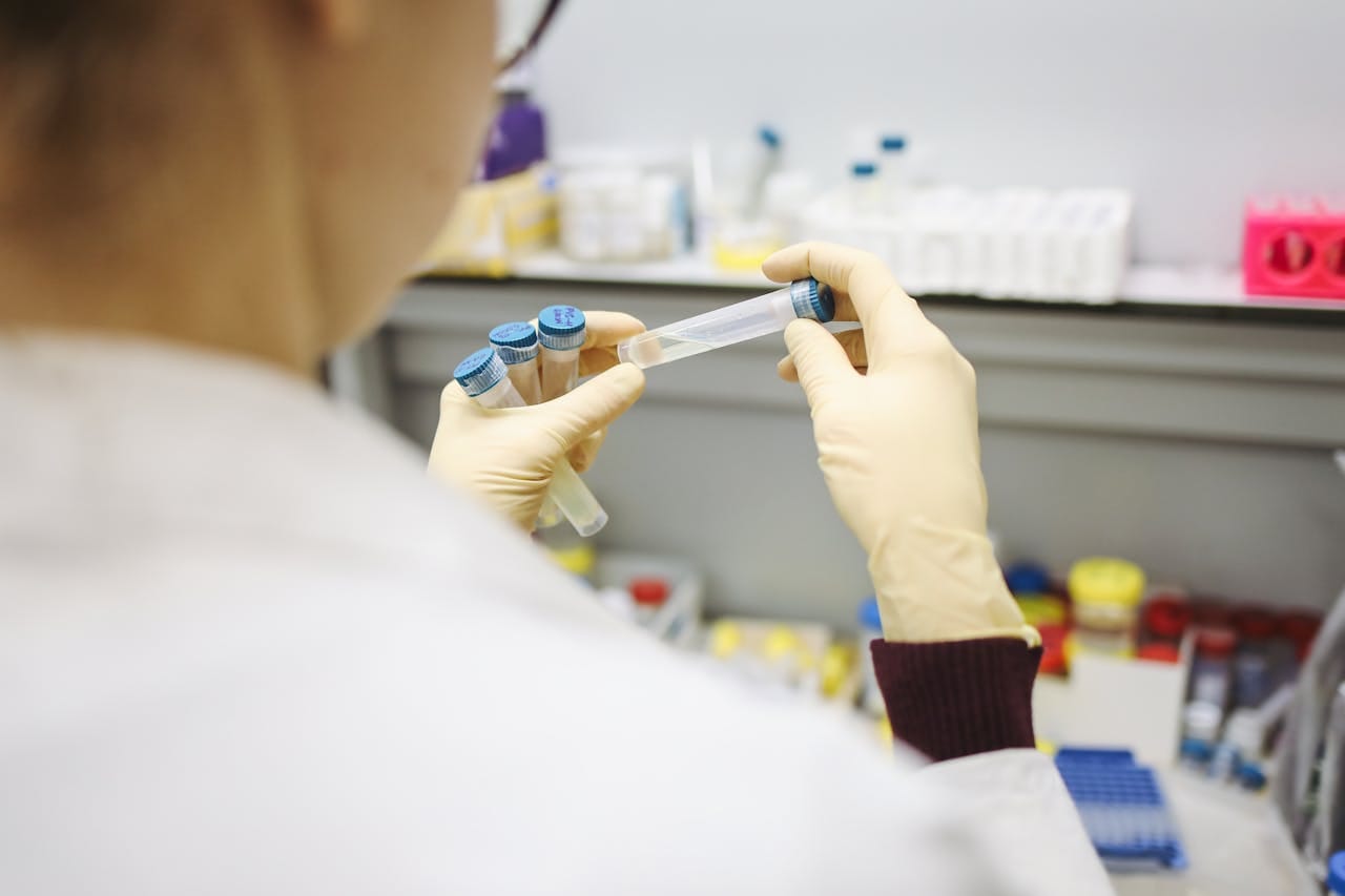 APLA Profile Test: What It Reveals About Your Health Risks