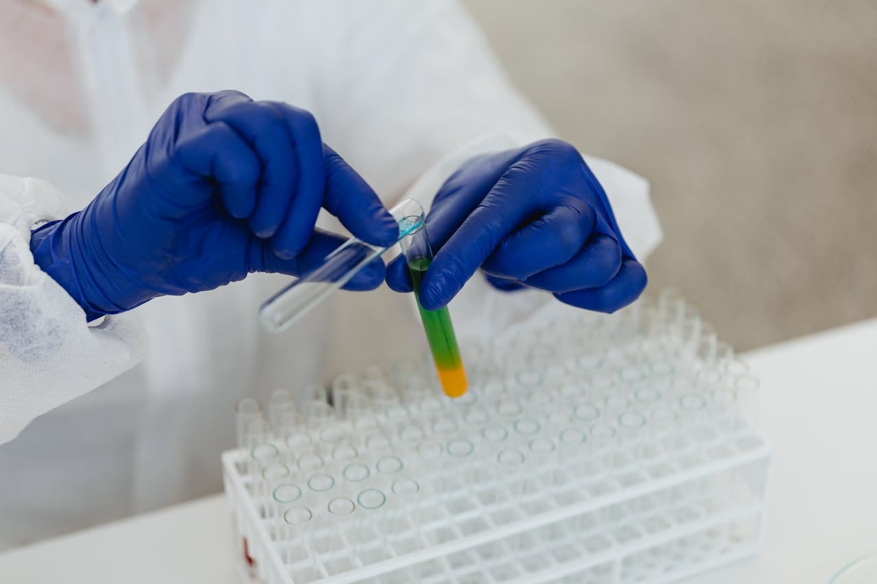 Triple Sugar Iron Test for Enterobacteriaceae Diagnosis