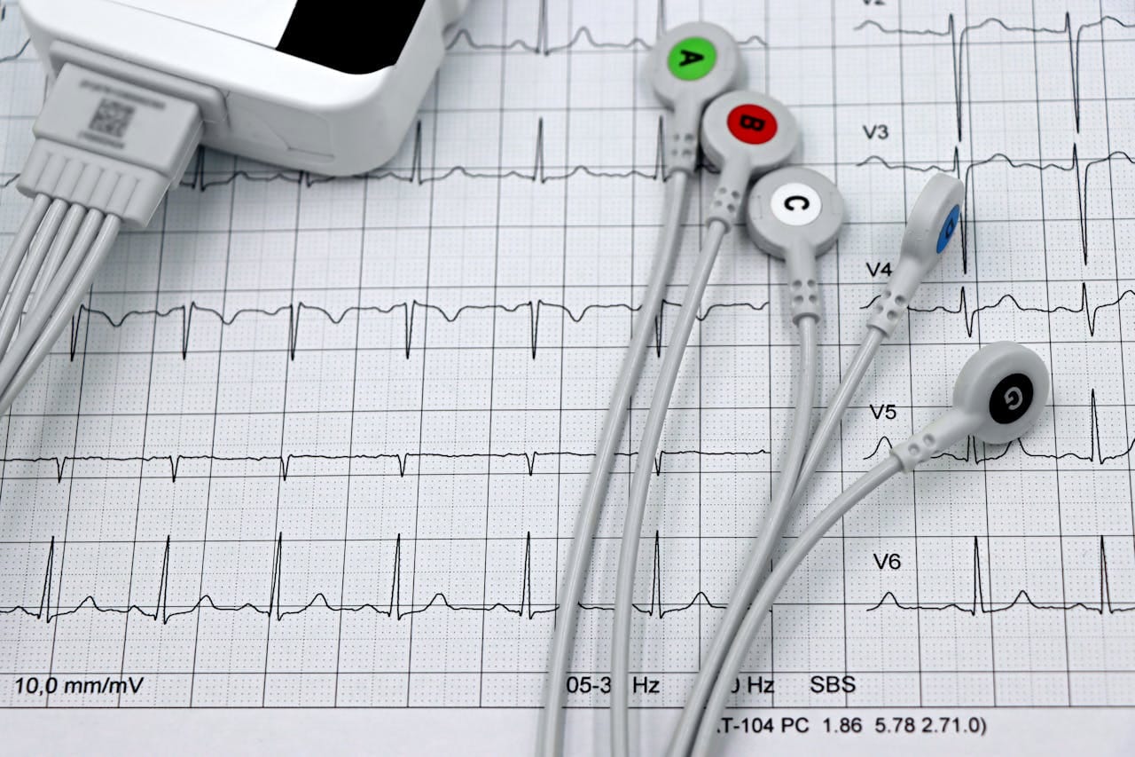 Pathology of Ischemic Heart Disease: Key Facts