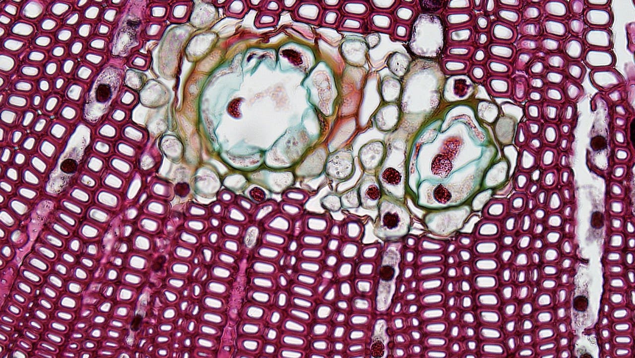 Principle of Acid-Fast Staining in Bacterial Identification