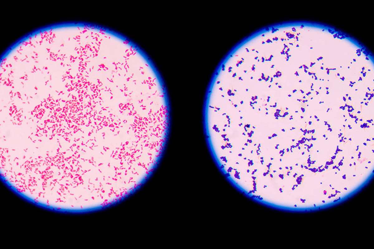 Gram Stain Test: What It Detects and How It Works