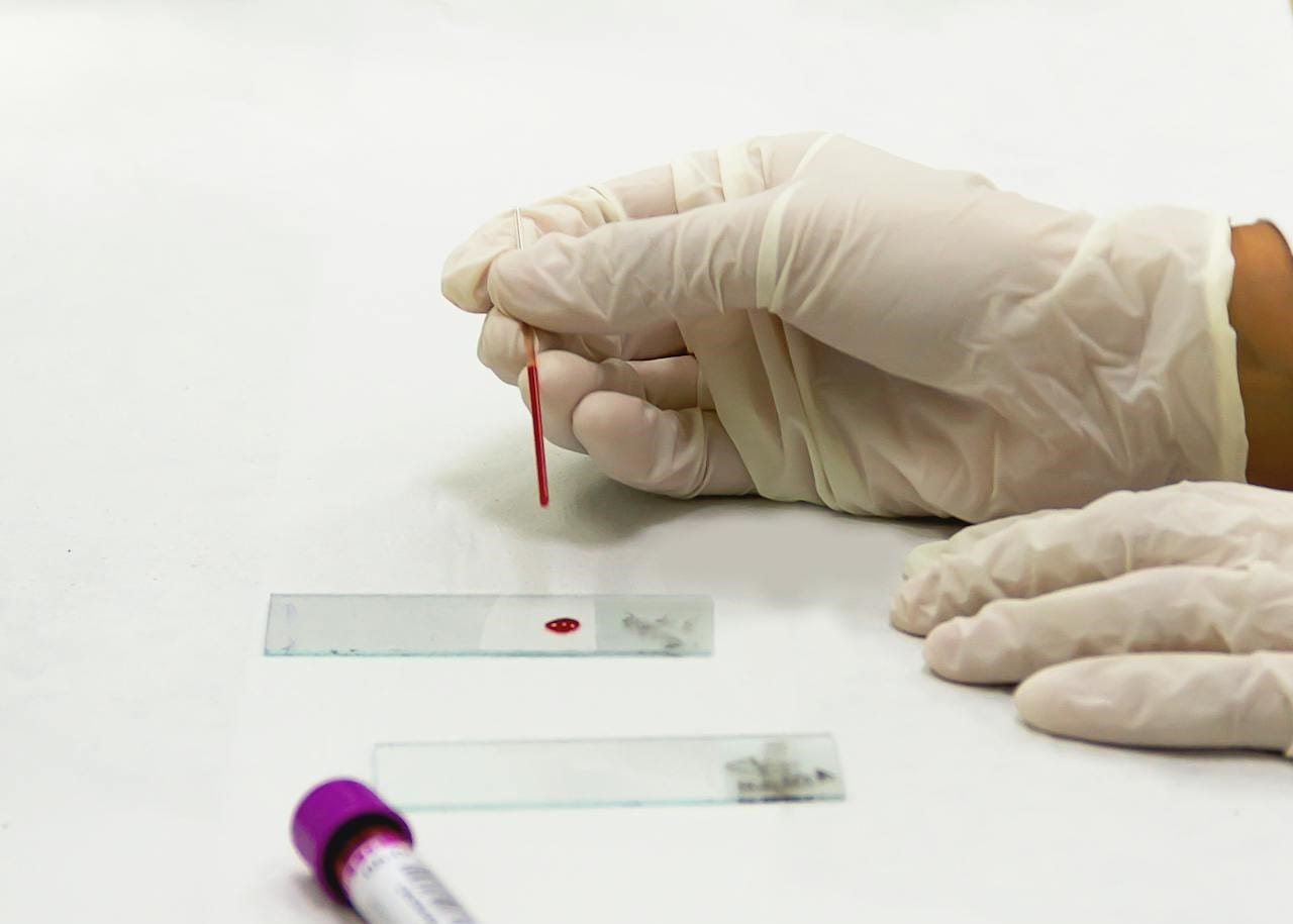 Basics of Capillary Blood Collection Techniques