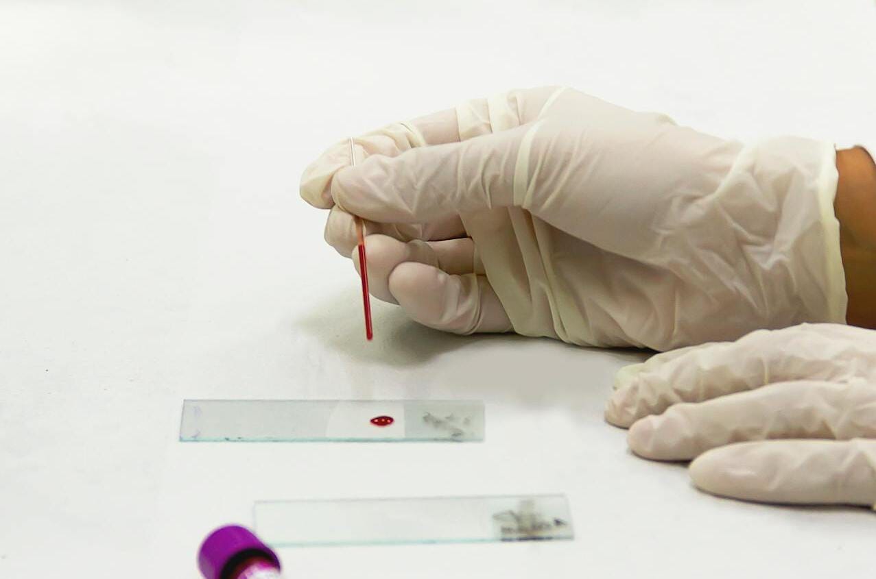 Normal Peripheral Blood Smear Report Format