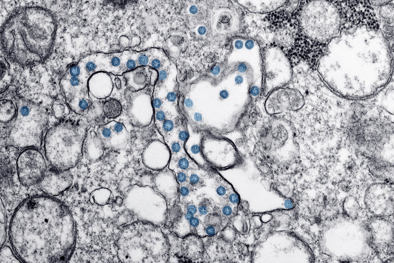 Endotoxin vs Exotoxin: Key Differences in Pathogens