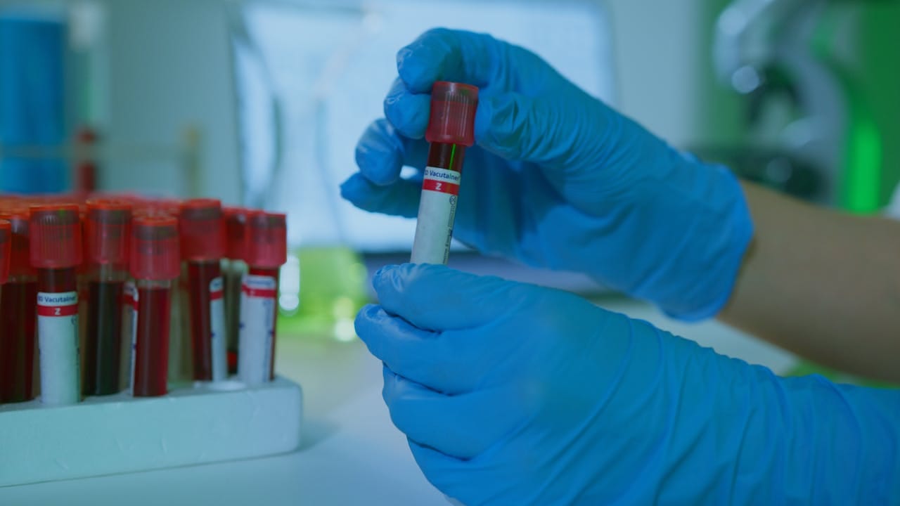 Blood Culture Tests: Understanding the Process and Importance