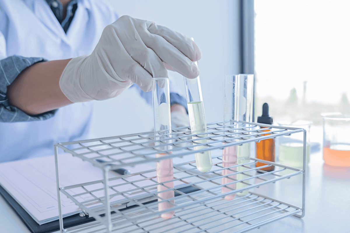 Urine RM Test: What to Expect & Health Insights