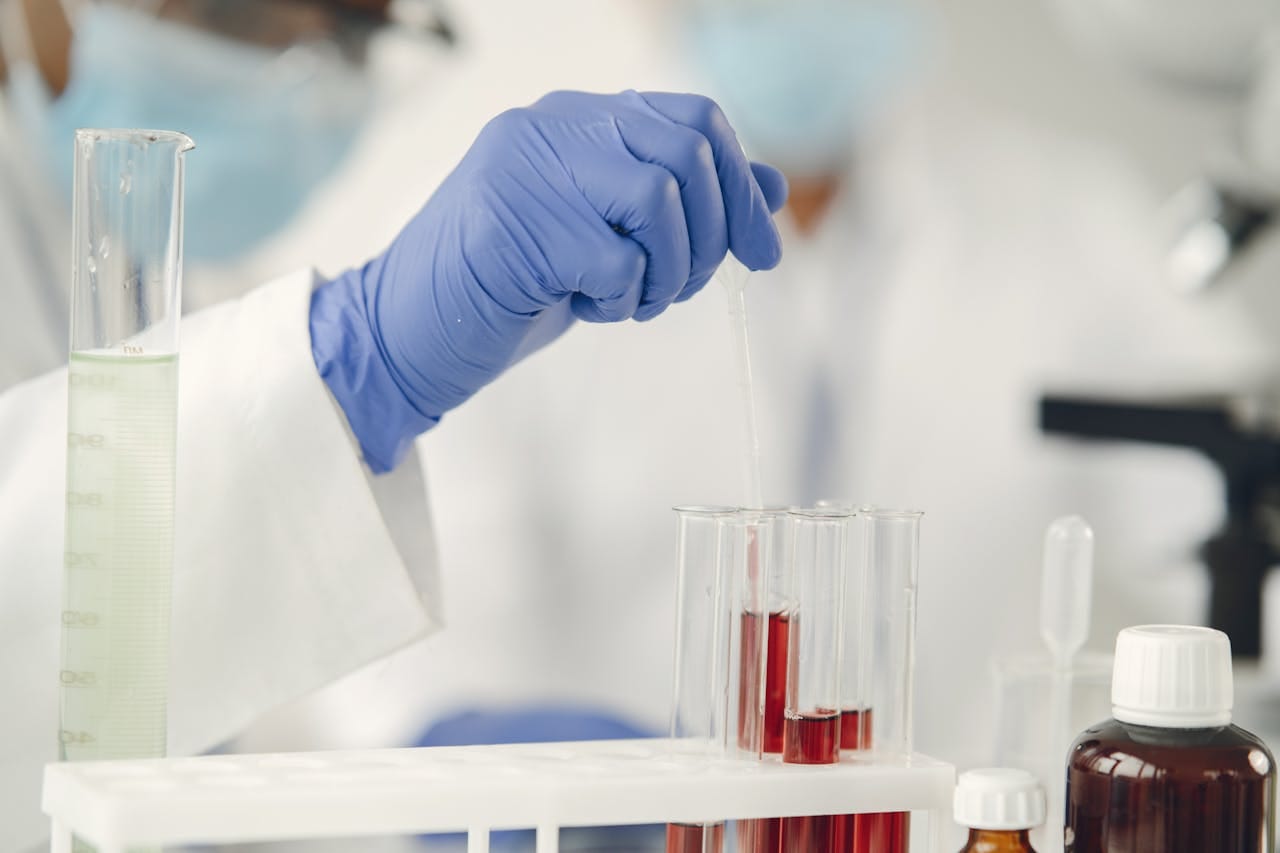 Antistreptolysin O (ASO) Test: Uses & Normal Range