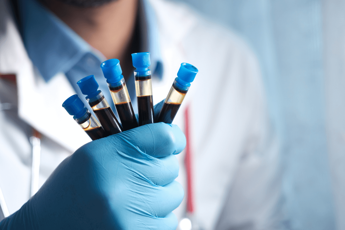 Carotid Doppler Test: Purpose, Procedure & Benefits