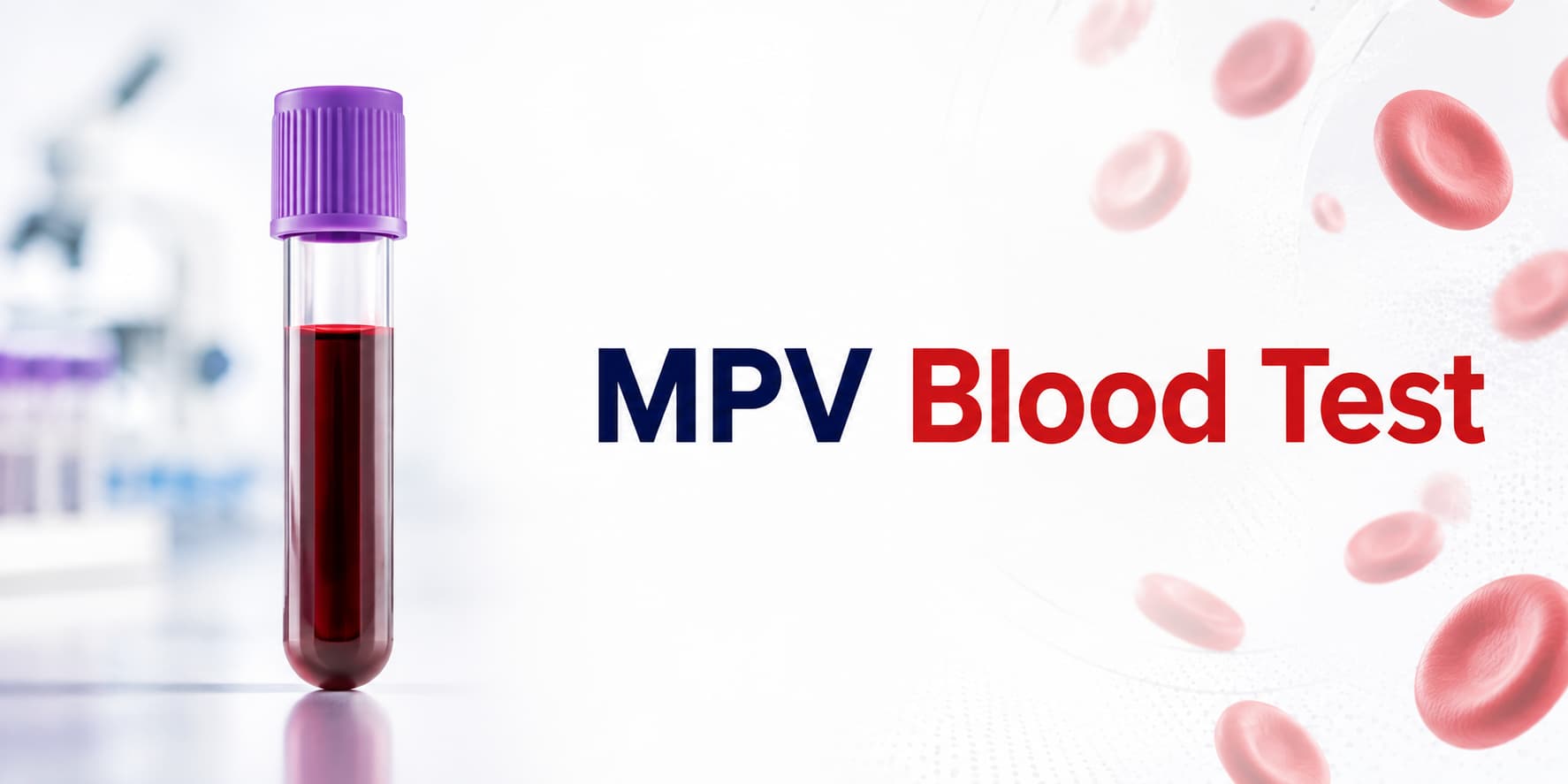 MPV Blood Test: High MPV Meaning, Causes & Normal Range