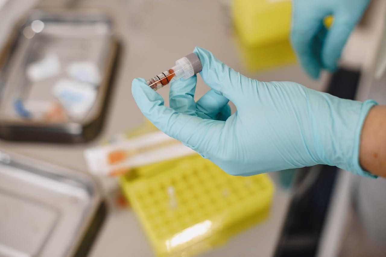 Procalcitonin Test: A Marker for Diagnosing Bacterial Infections