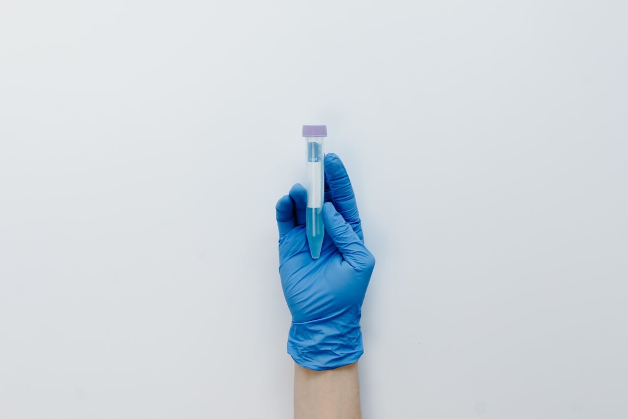 Serum vs Plasma: Key Differences Explained for Lab Tests