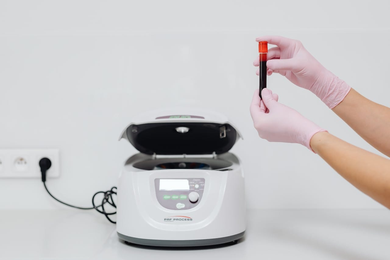 What Is UIBC in Blood Test? Meaning & Importance