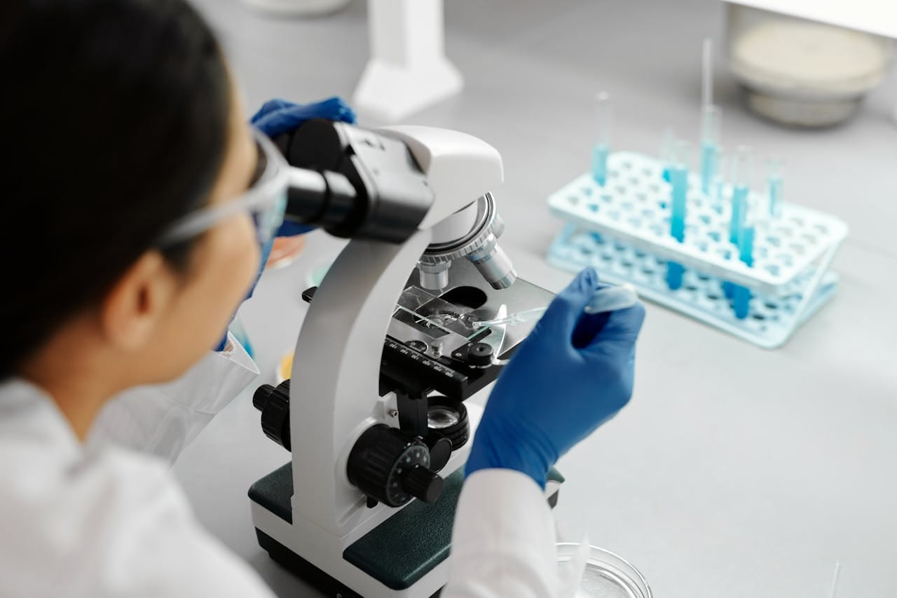 Uric Acid Report Format - Download Free PDF Sample